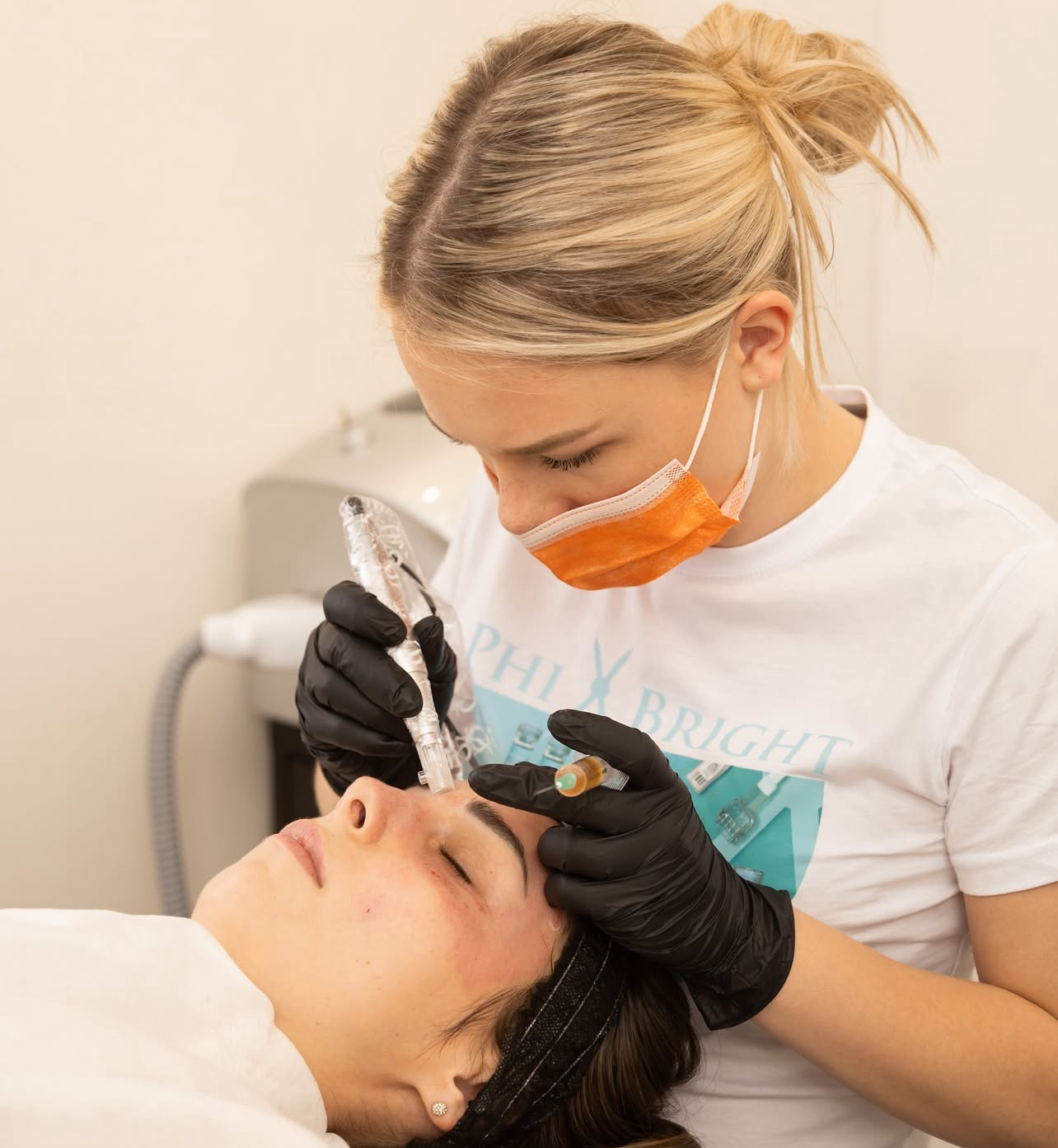 Microneedling procedure